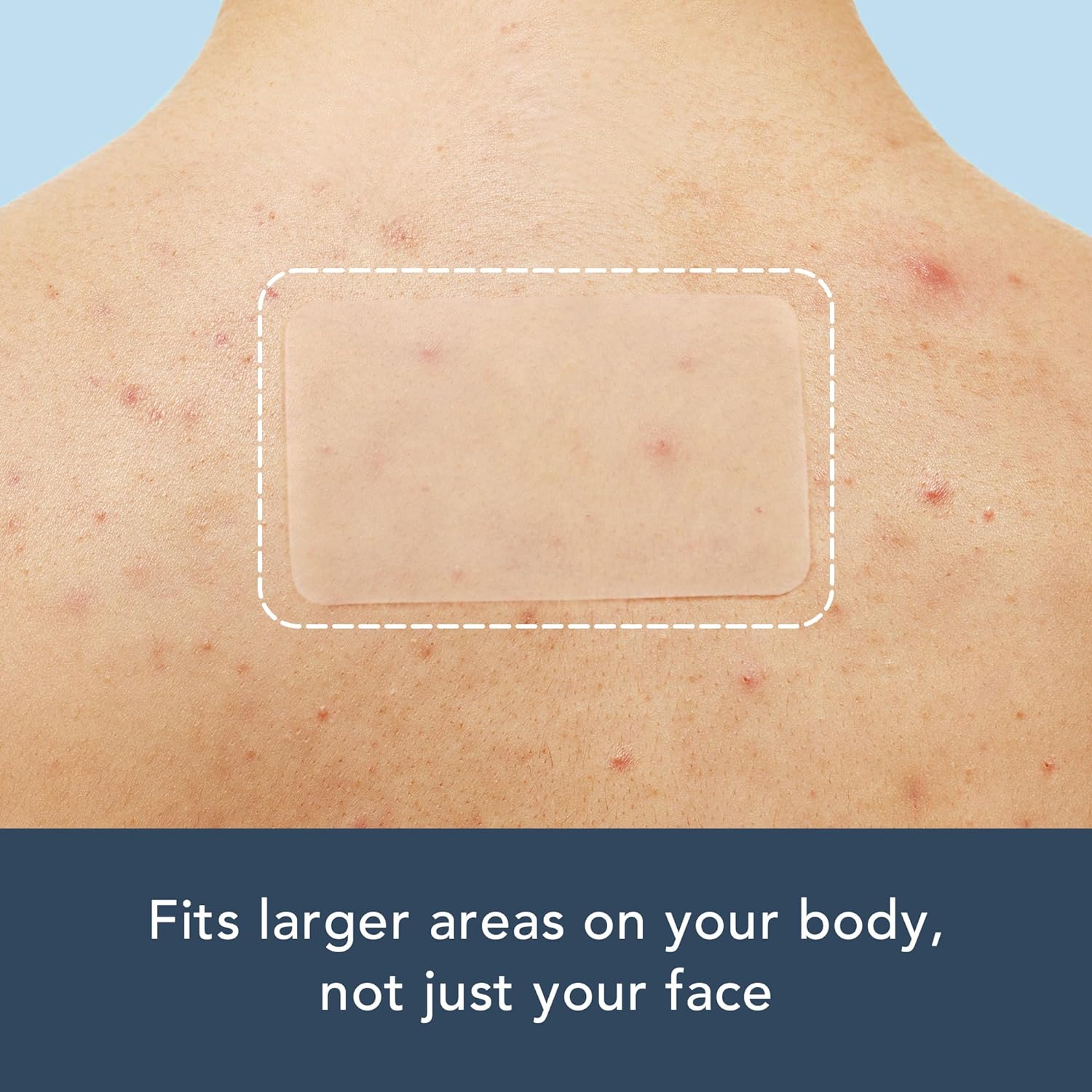 15 remendos longos para acne d - Body Oil avaliação e preço